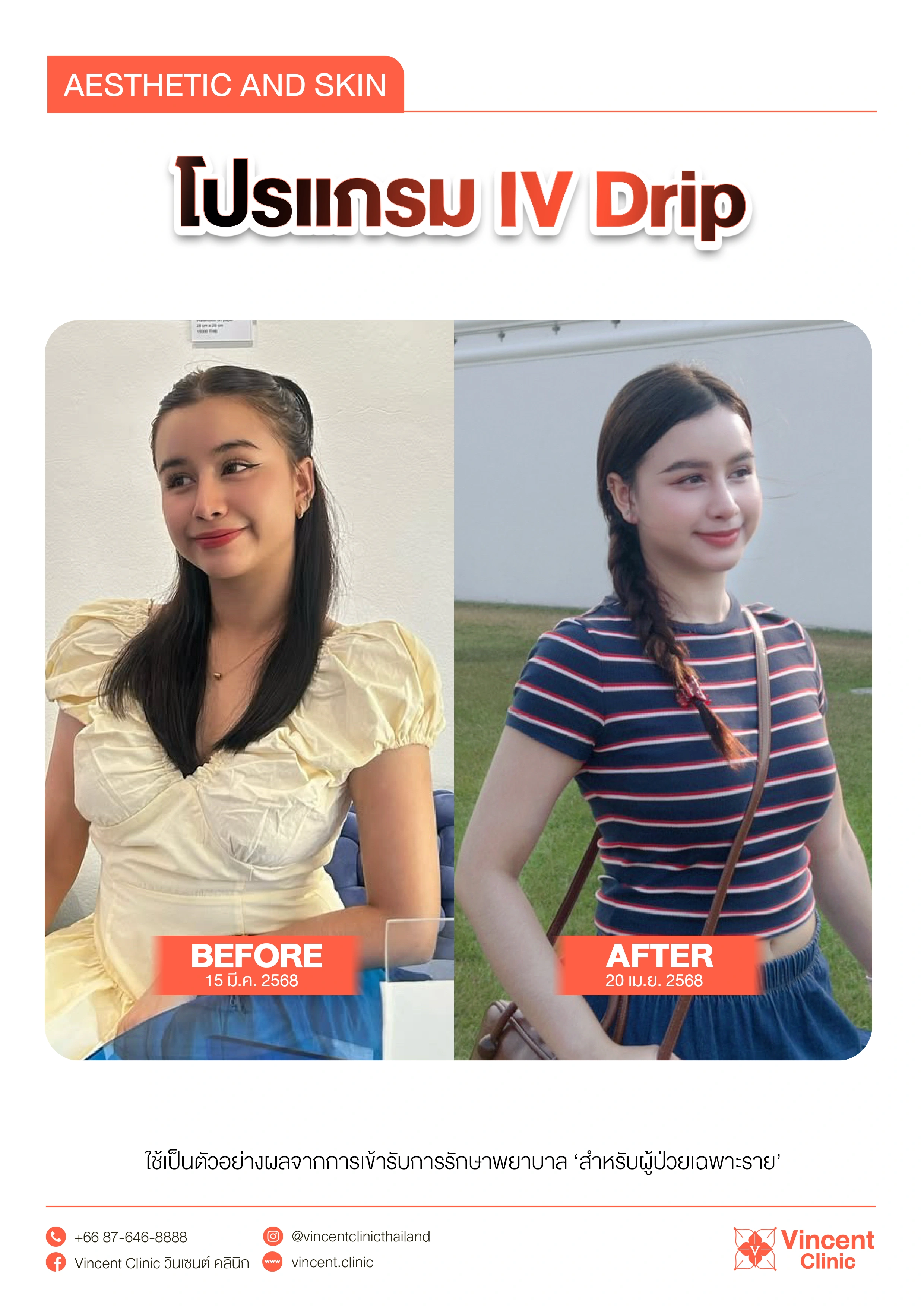 glutathione federal way wa Glutathione Liposomal